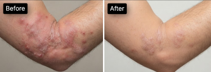 before after 4